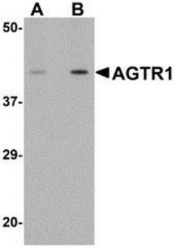 AGTR-1 Antibody - BSA Free, Novus Biologicals:Antibodies:Primary Antibodies