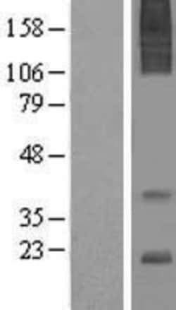 Novus Biologicals&trade;&nbsp;AGTRAP Overexpression Lysate