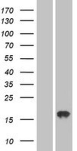 Novus Biologicals&trade;&nbsp;AGTRAP Overexpression Lysate