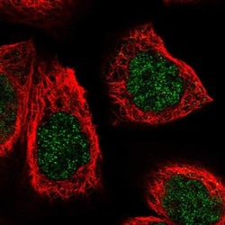 AGXT2 Antibody, Novus Biologicals:Antibodies:Primary Antibodies