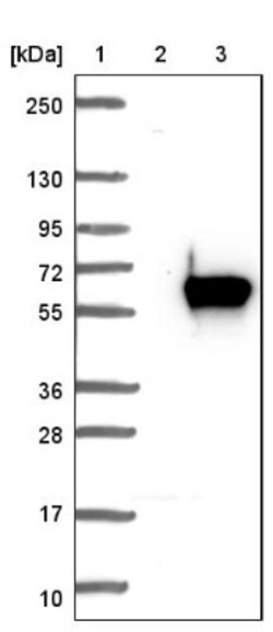 AGXT2L1 Antibody, Novus Biologicals 0.1mL; Unlabeled:Antibodies, Polyclonal