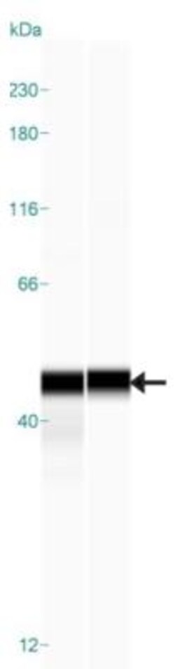 AGXT Antibody, Novus Biologicals:Antibodies:Primary Antibodies