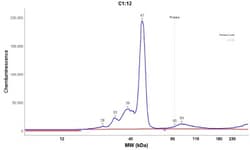 AGXT Antibody, Novus Biologicals:Antibodies:Primary Antibodies