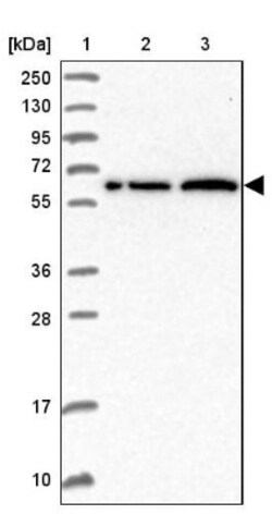 AHCYL1 Antibody, Novus Biologicals 0.1mL; Unlabeled:Antibodies, Polyclonal