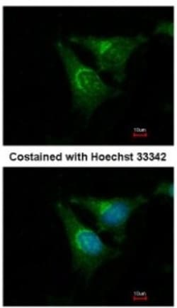 AHI1 Antibody, Novus Biologicals 0.1mL; Unlabeled:Antibodies, Polyclonal