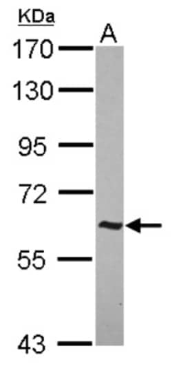 AHI1 Antibody, Novus Biologicals 0.1mL; Unlabeled:Antibodies, Polyclonal