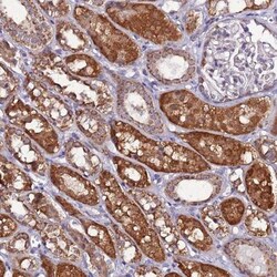 AHI1 Antibody, Novus Biologicals:Antibodies:Primary Antibodies