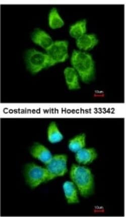 AHSA1 Antibody, Novus Biologicals 0.1mL; Unlabeled:Antibodies, Polyclonal