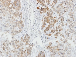 AHSA1 Antibody, Novus Biologicals 0.1mL; Unlabeled:Antibodies, Polyclonal