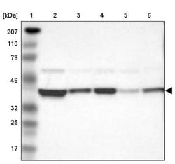 AHSA1 Antibody, Novus Biologicals 25 &mu;L; Unlabeled:Antibodies, Polyclonal