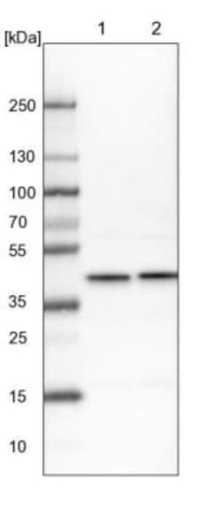 AHSA1 Antibody, Novus Biologicals 25 &mu;L; Unlabeled:Antibodies, Polyclonal