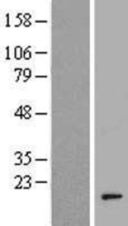 Novus Biologicals™ AHSA2 Overexpression Lysate