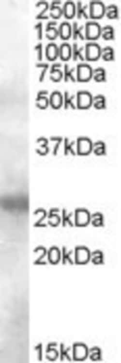 AICDA Antibody, Novus Biologicals 0.1mg; Unlabeled:Antibodies, Polyclonal