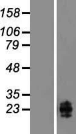 Novus Biologicals™ AICL Overexpression Lysate
