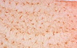 AIF-1/Iba1 Antibody, Novus Biologicals 0.1mg; Unlabeled:Antibodies, Polyclonal