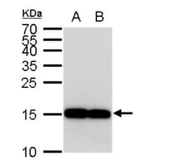 AIF-1/Iba1 Antibody, Novus Biologicals 0.1mg; Unlabeled:Antibodies, Polyclonal