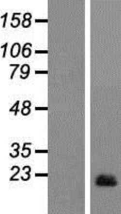 Novus Biologicals&trade;&nbsp;AIF1L Overexpression Lysate