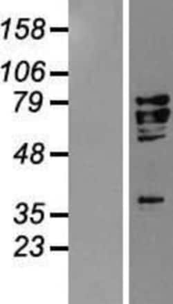 Novus Biologicals&trade;&nbsp;AIF Overexpression Lysate