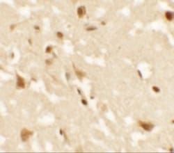 AIG1 Antibody - BSA Free, Novus Biologicals 0.025 mg, Unlabeled:Antibodies,