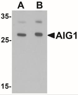 AIG1 Antibody - BSA Free, Novus Biologicals 0.025 mg, Unlabeled:Antibodies,