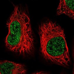 AIM1L Antibody, Novus Biologicals 0.1mL; Unlabeled:Antibodies, Polyclonal
