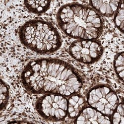AIM1L Antibody, Novus Biologicals:Antibodies:Primary Antibodies