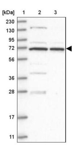 AIM1L Antibody, Novus Biologicals 0.1mL; Unlabeled:Antibodies, Polyclonal