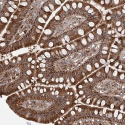 AIM2 Antibody, Novus Biologicals:Antibodies:Primary Antibodies