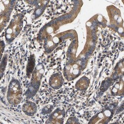 AIMP2 Antibody, Novus Biologicals 25 &mu;L; Unlabeled:Antikörper