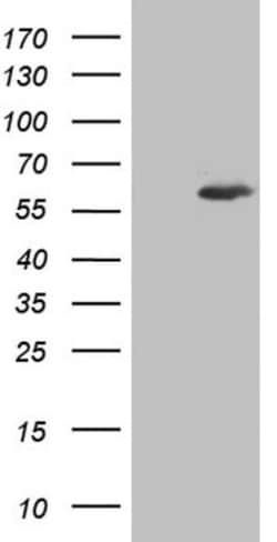 Aiolos/IKZF3 Antibody (OTI7E11), Novus Biologicals 0.1mL; Unlabeled:Antikroppar