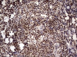 Aiolos/IKZF3 Antibody (OTI7E11), Novus Biologicals 0.1mL; Unlabeled:Antikroppar