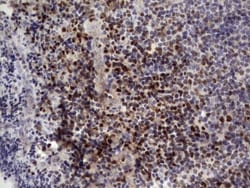 Aiolos/IKZF3 Antibody (OTI7E11), Novus Biologicals 0.1mL; Unlabeled:Antikroppar