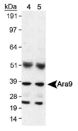 AIP/ARA9 Antibody (35-2), Novus Biologicals 0.025mL; Unlabeled:Antibodies,