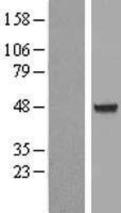 Novus Biologicals&trade;&nbsp;AIPL1 Overexpression Lysate