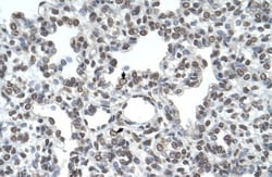 Airway Trypsin-like Protease/HAT/TMPRSS11D Antibody, Novus Biologicals:Antibodies:Primary