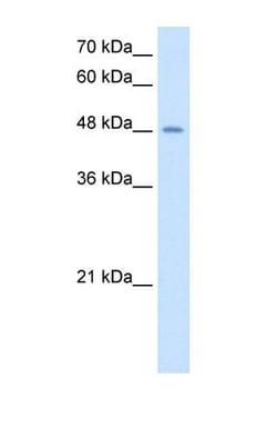 Airway Trypsin-like Protease/HAT/TMPRSS11D Antibody, Novus Biologicals:Antibodies:Primary
