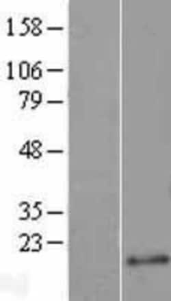 Novus Biologicals&trade;&nbsp;Ajuba Overexpression Lysate