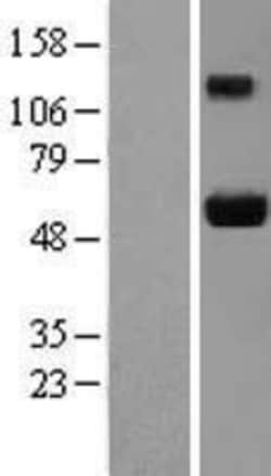 Novus Biologicals&trade;&nbsp;Ajuba Overexpression Lysate