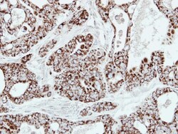 AK2 Antibody, Novus Biologicals 0.1mg; Unlabeled:Antibodies, Polyclonal