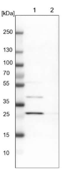 AK2 Antibody, Novus Biologicals 0.1mL; Unlabeled:Antibodies, Polyclonal