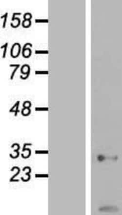 Novus Biologicals&trade;&nbsp;AK2 Overexpression Lysate