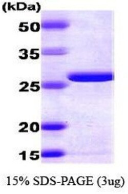 Novus Biologicals&trade;&nbsp;Recombinant Human AK2 His Protein