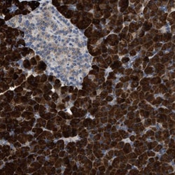 AK2 Antibody, Novus Biologicals 0.1mL; Unlabeled:Antibodies, Polyclonal