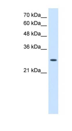 AK2 Antibody, Novus Biologicals 100μL; Unlabeled:Antibodies, Polyclonal