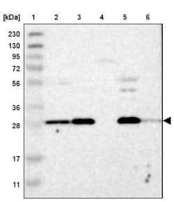AK2 Antibody, Novus Biologicals 0.1mL; Unlabeled:Antibodies, Polyclonal