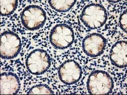 AK3 Antibody (OTI6G4), Novus Biologicals 0.1mL; Unlabeled:Antibodies, Monoclonal