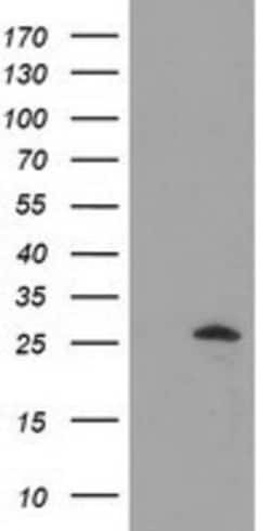 AK3 Antibody (OTI6G4), Novus Biologicals 0.1mL; Unlabeled:Antibodies, Monoclonal