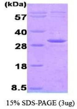 Novus Biologicals&trade;&nbsp;Recombinant Human AK3 His Protein