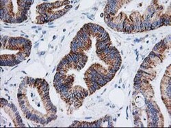 AK3L1 Antibody (OTI3B1), Novus Biologicals 0.1mL; Unlabeled:Antibodies,