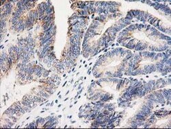 AK3L1 Antibody (OTI3B1), Novus Biologicals 0.1mL; Unlabeled:Antibodies,